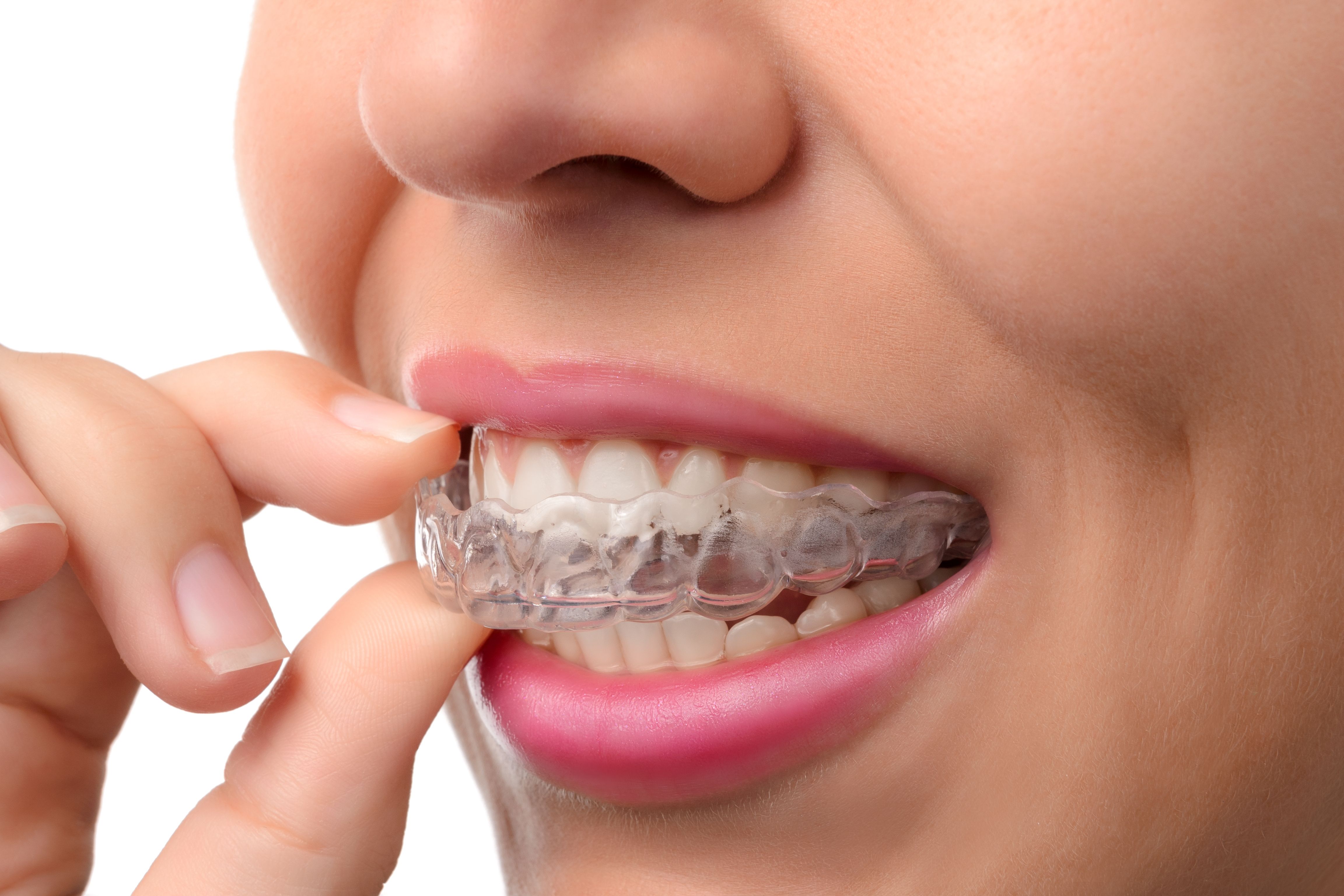 Advanced Dentistry of Nevada, MO Advanced Dentistry of Nevada, MO