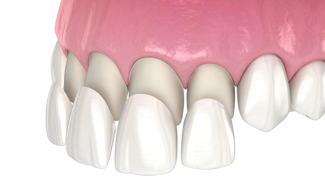 Advanced Dentistry of Nevada, MO Advanced Dentistry of Nevada, MO