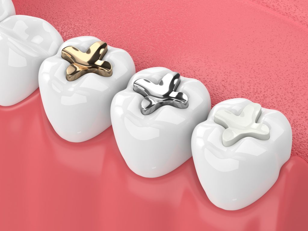 Advanced Dentistry of Nevada, MO Advanced Dentistry of Nevada, MO