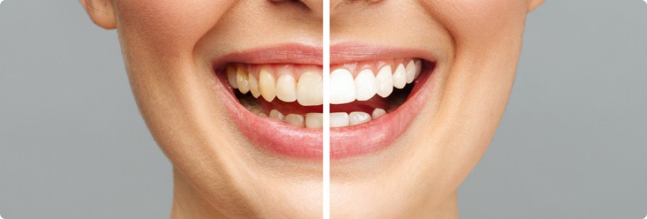 Advanced Dentistry of Nevada, MO Advanced Dentistry of Nevada, MO
